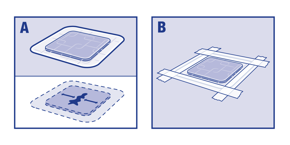 Due immagini che mostrano la modalità di applicazione di Cutimed Sorbion Carbon+ XL Due immagini che mostrano la modalità di applicazione di Cutimed Sorbion Carbon+ XL